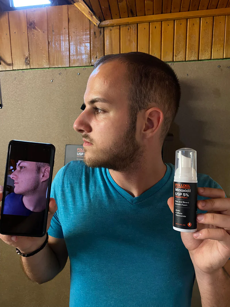 Reclaim Your Hair and Confidence